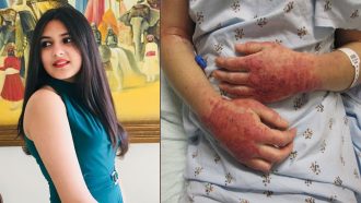 ভয়ংকর বিরল রোগে ‘দঙ্গল’ কন্যার মৃত্যু, কি সেই রোগ?