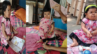 ৩৪ বছরের মিলি এখনো শিশু, উচ্চতা ২৮ ইঞ্চি