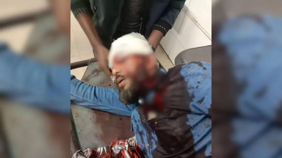 খুলনায় এনসিপি নেতাকে প্রকাশ্যে গুলি, অবস্থা ‘আশঙ্কাজনক’