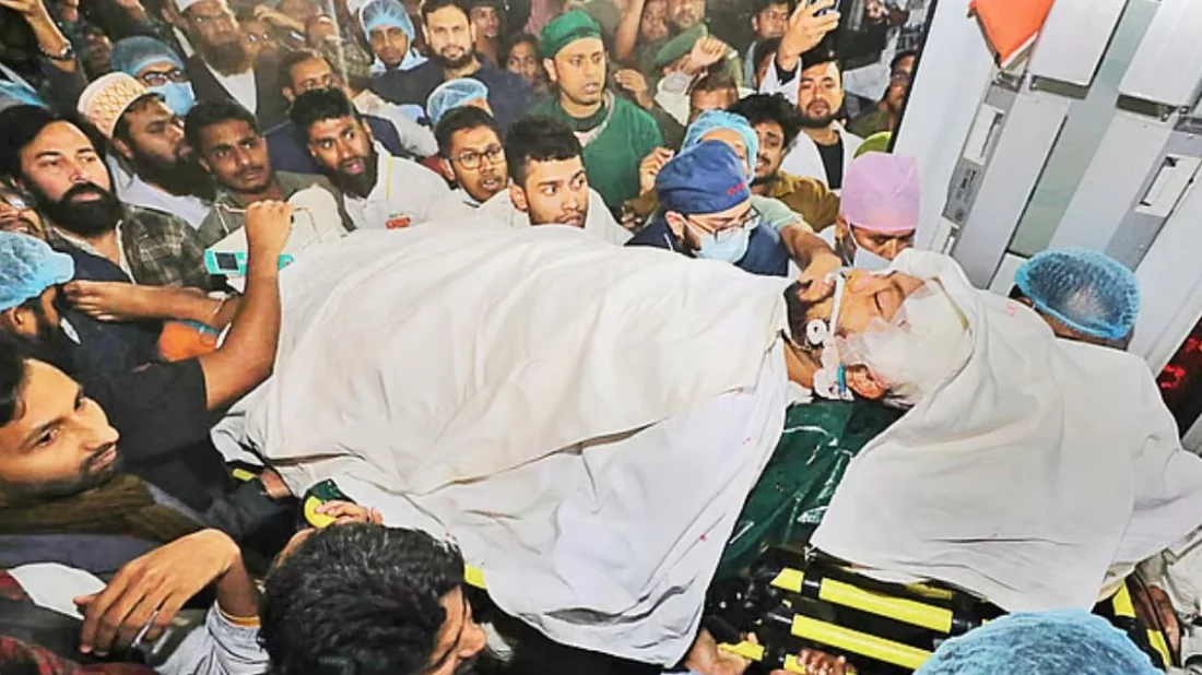 হাদির অবস্থার উন্নতি নেই, স্থিতিশীল হলে বিদেশে নেওয়ার চিন্তা