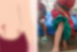 হবিগঞ্জে পাগলা কুকুরের কামড়ে স্কুল ছাত্রীসহ আ হ ত অর্ধশত